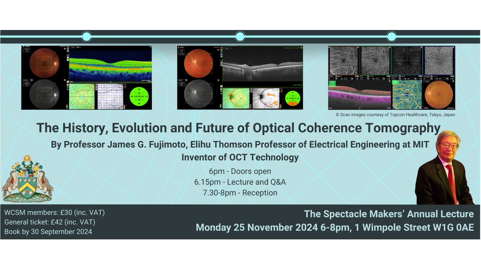The History, Evolution and Future Prospects of Optical Coherence Tomography